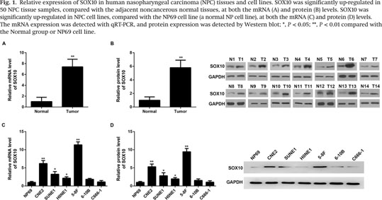 Health Reference Center Academic Document Sox10 Induces Epithelial Mesenchymal Transition And Contributes To Nasopharyngeal Carcinoma Progression