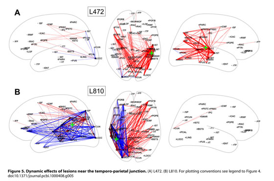 Gale Academic Onefile Document Modeling The Impact Of Lesions