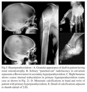 Gale Academic Onefile Document Radiographic Signals Detection