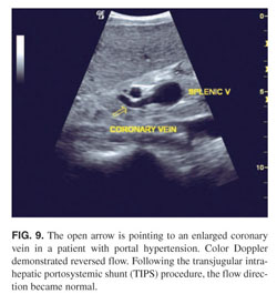 coronary vein portal hypertension