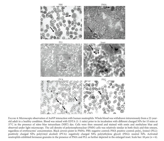 Assessment of Charged AuNPs: From Synthesis to Innate Immune 