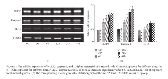 Maresin 1 Mitigates High Glucose Induced Mouse Glomerular Mesangial Cell Injury By Inhibiting Inflammation And Fibrosis Document Gale Onefile Health And Medicine