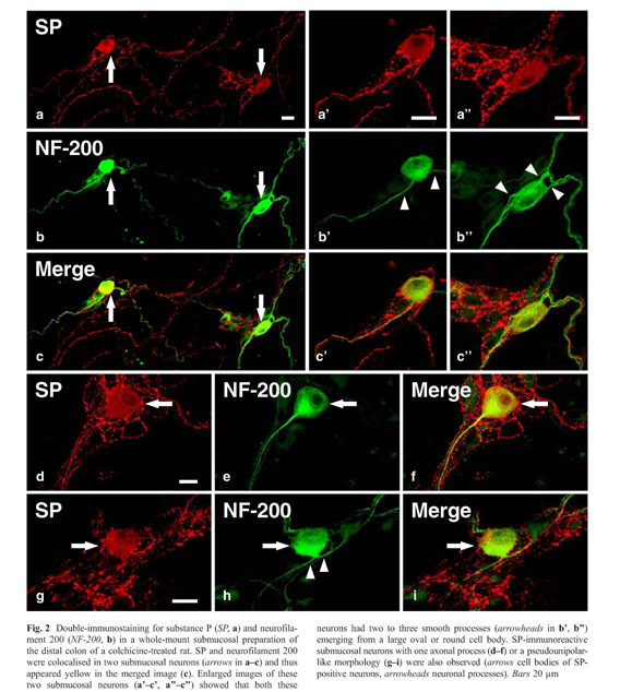 Immunohistochemical characteristics of submucosal Dogiel type II