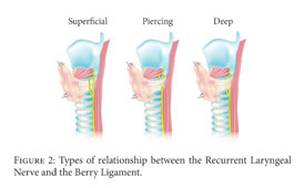 The Reliability Of The Tracheoesophageal Groove And The Ligament Of Berry As Landmarks For Identifying The Recurrent Laryngeal Nerve A Cadaveric Study And Meta Analysis Document Gale Academic Onefile