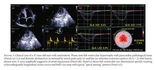 Layer‐specific strain echocardiography may reflect regional myocardial  impairment in patients with hypertrophic cardiomyopathy, Cardiovascular  Ultrasound