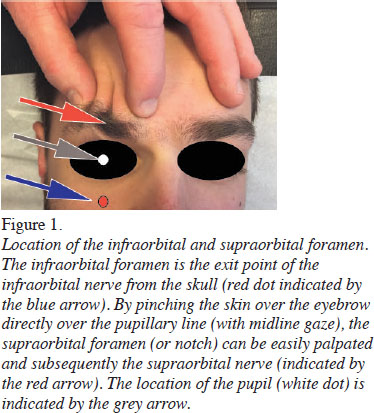 Nerf facial : anatomie, pathologies, traitements