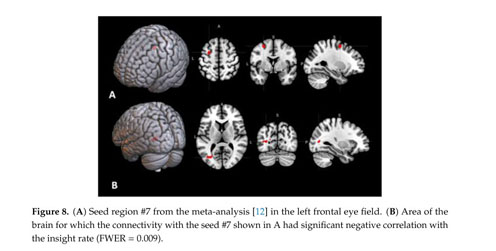 Brain Activations And Functional Connectivity Patterns Associated With Insight Based And Analytical Anagram Solving Document Gale Academic Onefile