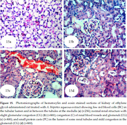 Nephroprotective Effect of Pleurotus ostreatus and Agaricus 