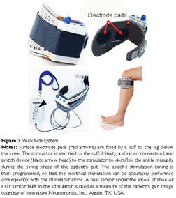 The electromyography (EMG)-driven neuromuscular electrical stimulation