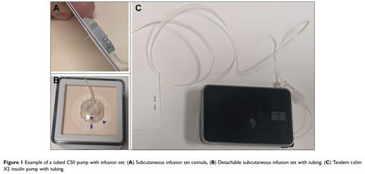 Commercially available subcutaneous CGM devices: (A) Dexcom G6