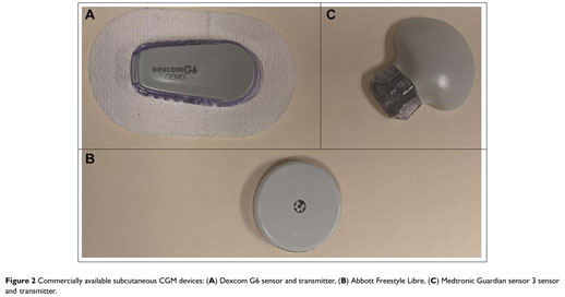 Commercially available subcutaneous CGM devices: (A) Dexcom G6