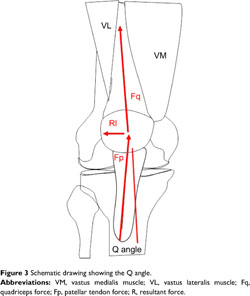 In vivo noninvasive evaluation of abnormal patellar tracking during  squatting in patients with patellofemoral pain.