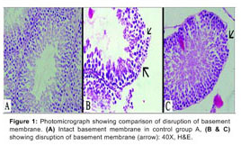 Effect of Lead Acetate on Basement Membrane of Seminiferous 