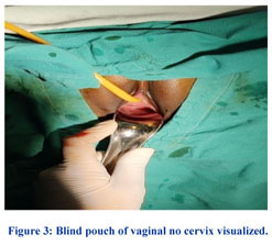 blind vaginal pouch