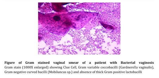 bacterial vaginosis gram stain