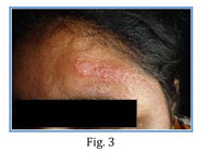 Vicks induced adverse drug reactions--rare case reports - Document - Gale  Academic OneFile