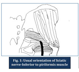 A minimally invasive surgical approach for the treatment of piriformis  syndrome: a case series, Chinese Neurosurgical Journal