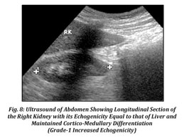 Gale Onefile Health And Medicine Document Sonographic Grading Of Renal Cortical Echogenicity And Raised Serum Creatinine In Patients With Chronic Kidney Disease