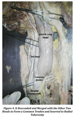 bicipital aponeurosis cadaver