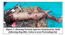 FATAL DOG BITE LEADING TO COLONIC INJURY--A CASE REPORT - Document - Gale  OneFile: Health and Medicine
