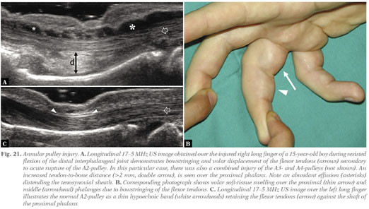 Anatomy of the median nerve and its clinical applications