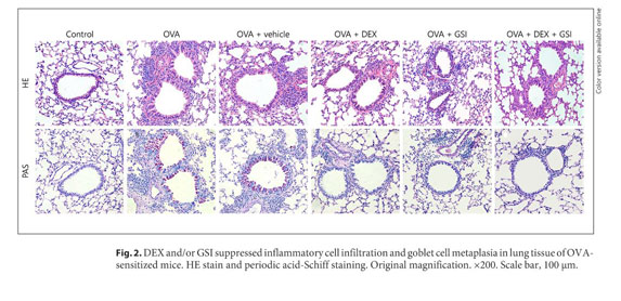 Glucocorticoids Modulate Th1 and Th2 Responses in Asthmatic Mouse