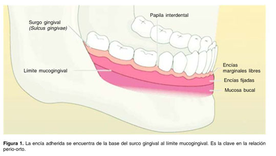 Informe Academico Document Cirugia Periodontal Aplicada A La Ortodoncia