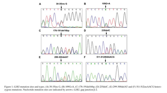 hidrojen kaynakça algısal  Gene mutation analysis and genetic counseling for patients with  non-syndromic hearing loss in Linyi region - Document - Gale Academic  OneFile