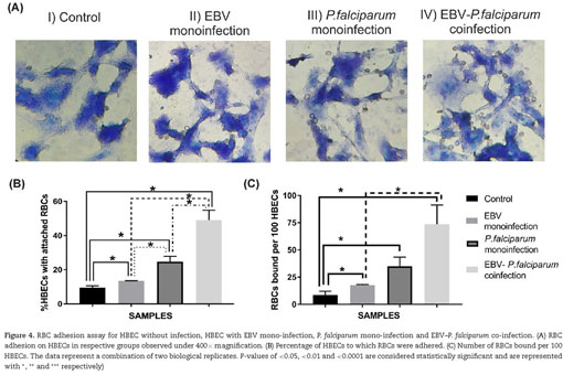 Temporal In Vitro Raman Spectroscopy for Monitoring Replication Kinetics of  Epstein–Barr Virus Infection in Glial Cells