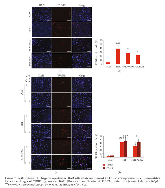 Gale Onefile Health And Medicine Document Wenxin Granule Ameliorates Hypoxia Reoxygenation Induced Oxidative Stress In Mitochondria Via The Pkc Delta Nox2 Ros Pathway In H9c2 Cells
