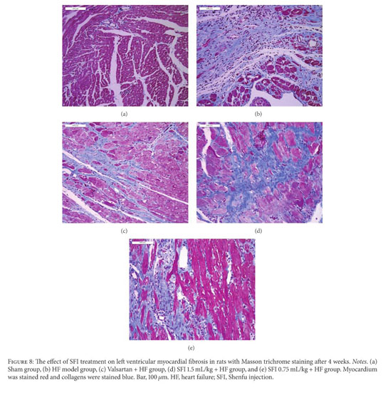 gale academic onefile document cardioprotection against heart failure by shenfu injection via tgf beta smads signaling pathway tgf beta smads signaling pathway