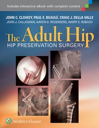 The Adult Hip, ed. 3, v. 