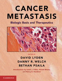 Cancer Metastasis, ed. , v. 