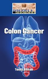 Colon Cancer, ed. , v. 