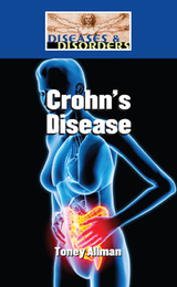 Crohn's Disease, ed. , v. 