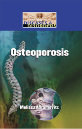 Osteoporosis, ed. , v. 