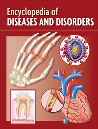 Encyclopedia of Diseases and Disorders, ed. , v. 