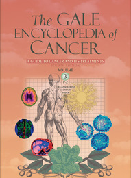 The Gale Encyclopedia of Cancer, ed. 4, v. 