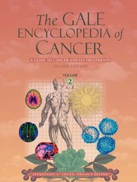 The Gale Encyclopedia of Cancer, ed. 2, v. 