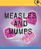 Measles and Mumps, ed. , v. 