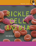 Sickle Cell Anemia, ed. , v. 