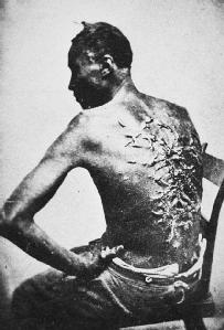 A slave or former slave whose back is severely scarred from whip lashes