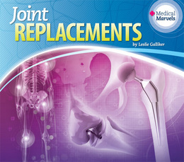Joint Replacements, ed. , v. 