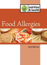 Food Allergies, ed. , v. 