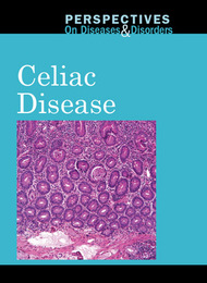 Celiac Disease, ed. , v. 