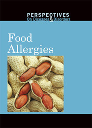 Food Allergies, ed. , v. 