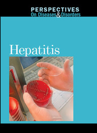 Hepatitis, ed. , v. 