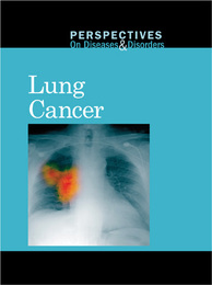 Lung Cancer, ed. , v. 