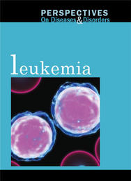 Leukemia, ed. , v. 