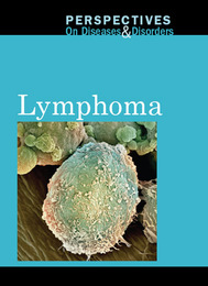 Lymphoma, ed. , v. 
